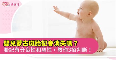 新生兒屁股胎記|胎記？蒙古斑？如何觀察與判斷診治｜Mombaby 媽媽 